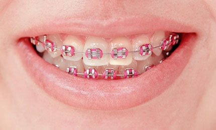 istock_000023058998small